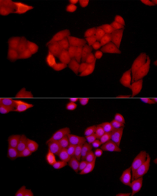 SIRT1 Antibody in Immunocytochemistry (ICC/IF)