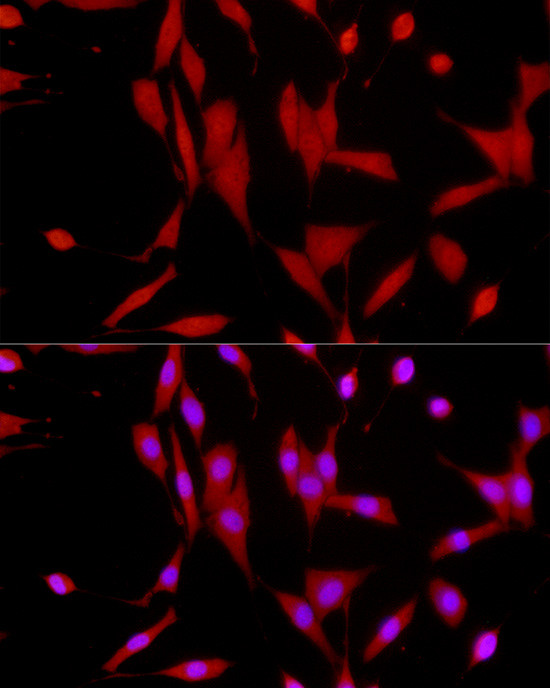 SIRT1 Antibody in Immunocytochemistry (ICC/IF)