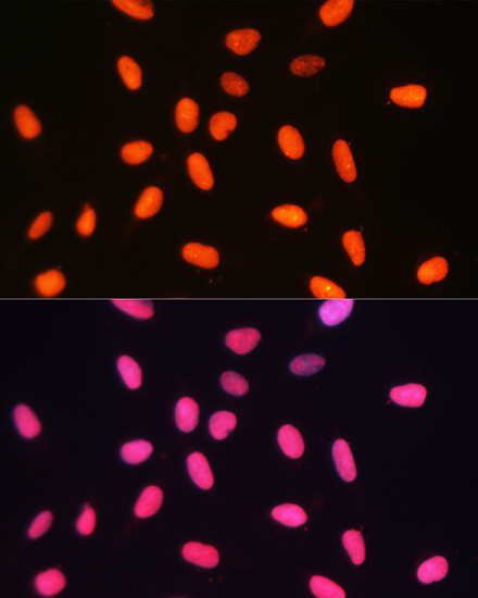 DNMT1 Antibody in Immunocytochemistry (ICC/IF)