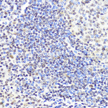 DNMT1 Antibody in Immunohistochemistry (Paraffin) (IHC (P))