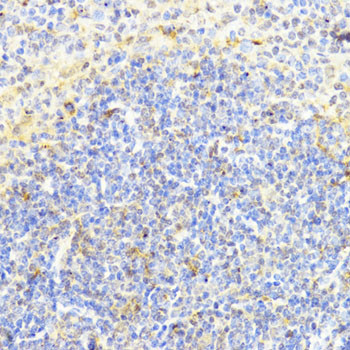 DNMT1 Antibody in Immunohistochemistry (Paraffin) (IHC (P))