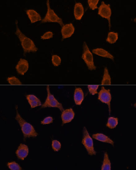 TMED2 Antibody in Immunocytochemistry (ICC/IF)