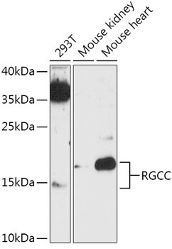 C13orf15 Antibody in Western Blot (WB)