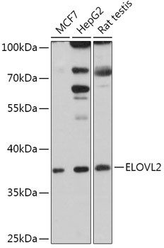 ELOVL2 Antibody in Western Blot (WB)