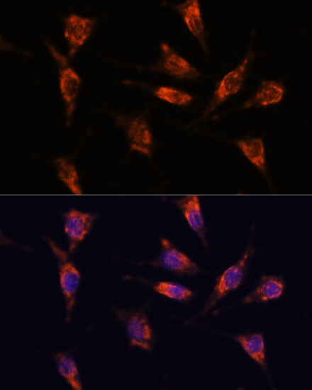 GNPNAT1 Antibody in Immunocytochemistry (ICC/IF)