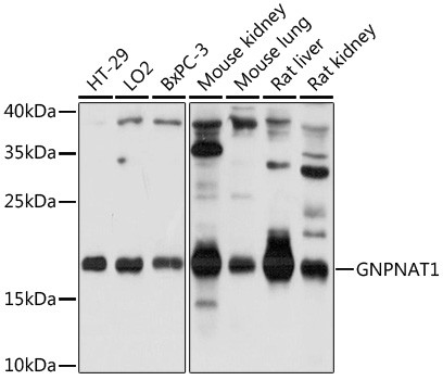 GNPNAT1 Antibody in Western Blot (WB)