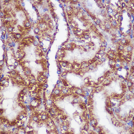 PIGM Antibody in Immunohistochemistry (Paraffin) (IHC (P))