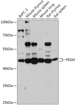 PIGM Antibody in Western Blot (WB)