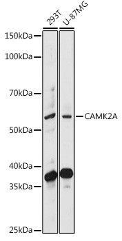 CaMKII alpha Antibody in Western Blot (WB)