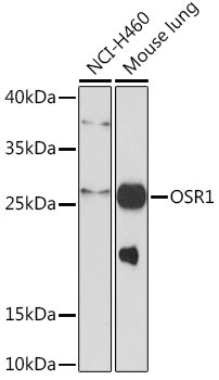 OSR1 Antibody in Western Blot (WB)