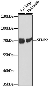 SENP2 Antibody in Western Blot (WB)