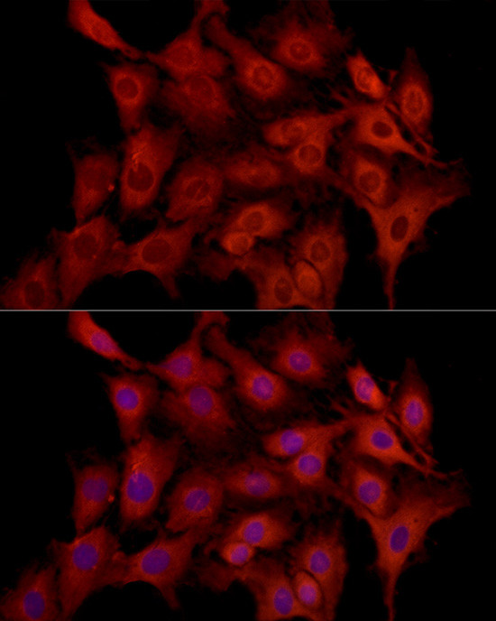 MCL-1 Antibody in Immunocytochemistry (ICC/IF)