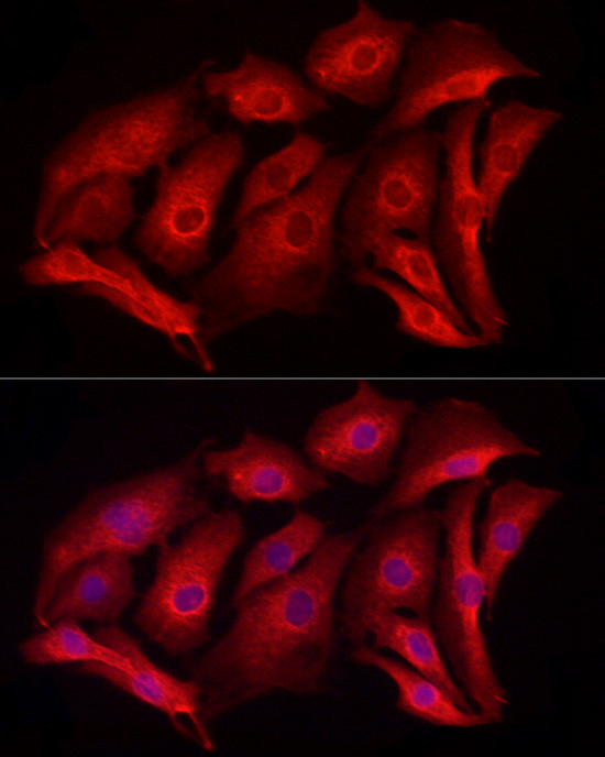 MCL-1 Antibody in Immunocytochemistry (ICC/IF)