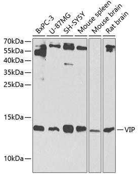 VIP Antibody in Western Blot (WB)