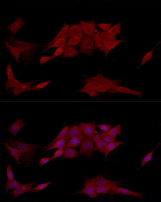 PTPN2 Antibody in Immunocytochemistry (ICC/IF)