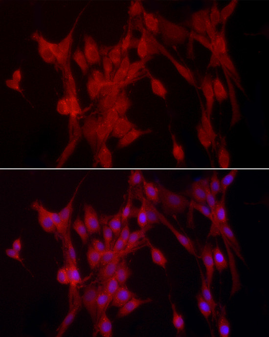 PTPN2 Antibody in Immunocytochemistry (ICC/IF)