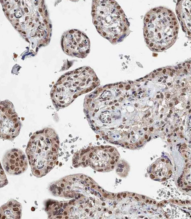 BAP1 Antibody in Immunohistochemistry (Paraffin) (IHC (P))