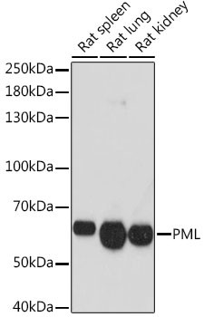 PML-5 Antibody in Western Blot (WB)