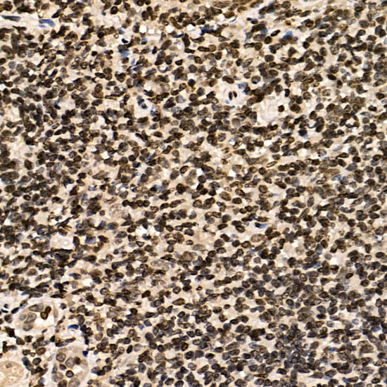 CSB Antibody in Immunohistochemistry (Paraffin) (IHC (P))