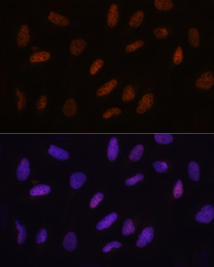 TET3 Antibody in Immunocytochemistry (ICC/IF)