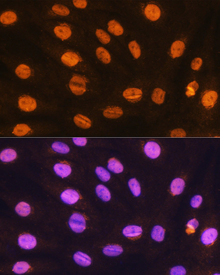 GTF3C3 Antibody in Immunocytochemistry (ICC/IF)