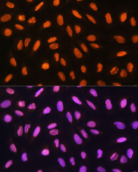 GTF3C3 Antibody in Immunocytochemistry (ICC/IF)