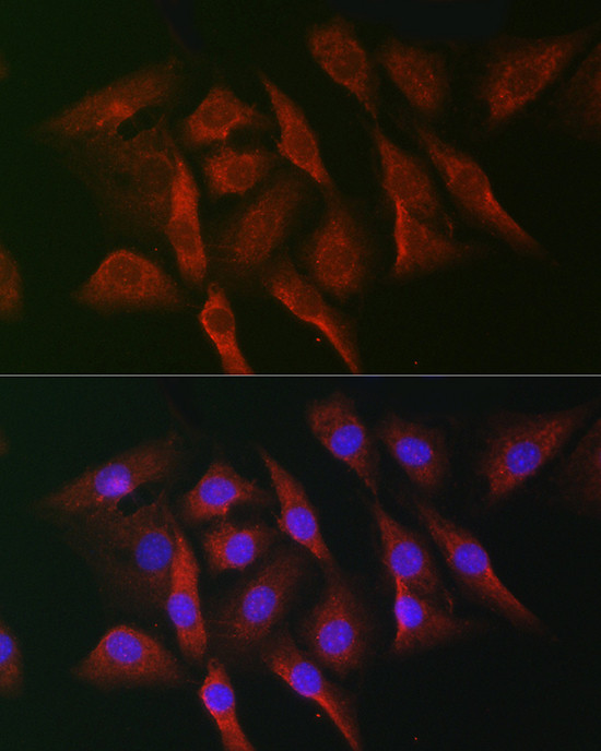 MNK1 Antibody in Immunocytochemistry (ICC/IF)