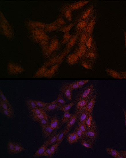 DJ-1 Antibody in Immunocytochemistry (ICC/IF)