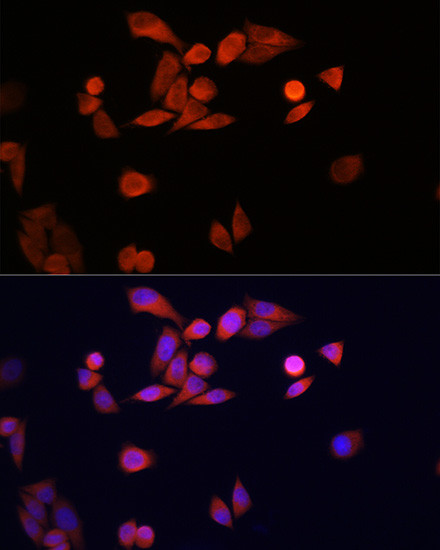 DJ-1 Antibody in Immunocytochemistry (ICC/IF)