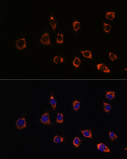 DJ-1 Antibody in Immunocytochemistry (ICC/IF)