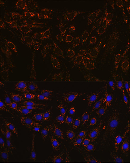 IFNAR1 Antibody in Immunocytochemistry (ICC/IF)