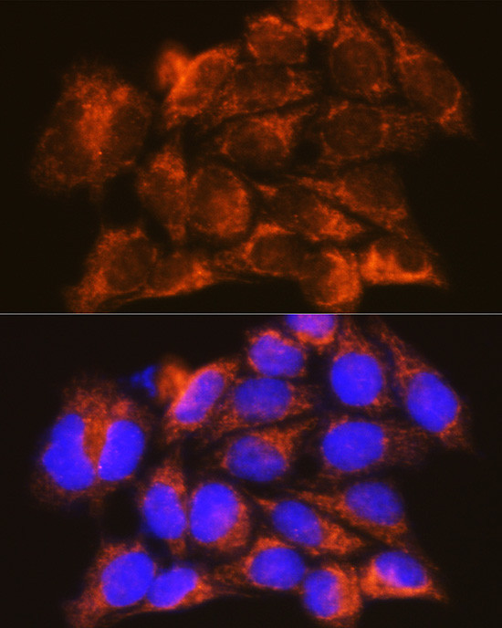 IFNAR1 Antibody in Immunocytochemistry (ICC/IF)