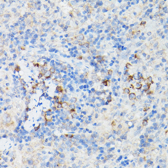 IFNAR1 Antibody in Immunohistochemistry (Paraffin) (IHC (P))