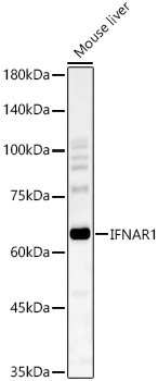 IFNAR1 Antibody in Western Blot (WB)