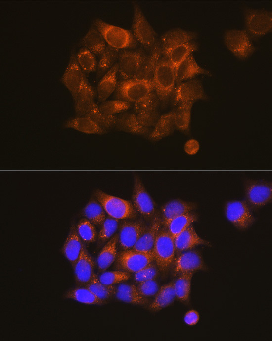 PKM1 Antibody in Immunocytochemistry (ICC/IF)