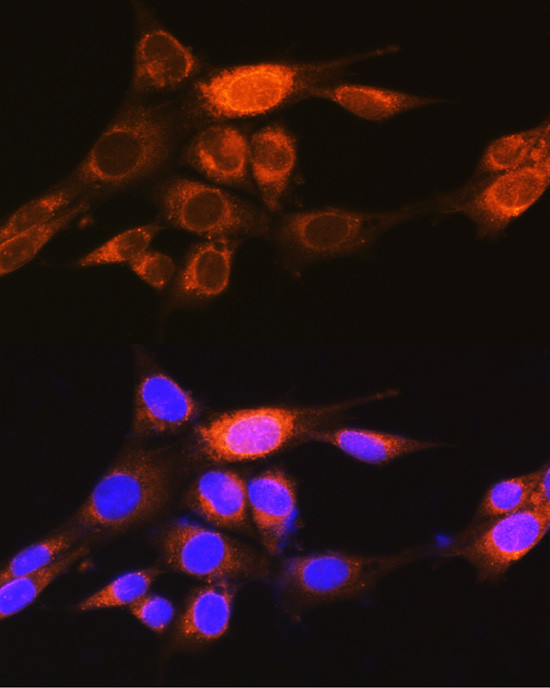 PKM1 Antibody in Immunocytochemistry (ICC/IF)