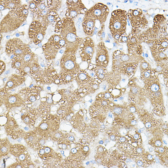 PKM1 Antibody in Immunohistochemistry (Paraffin) (IHC (P))