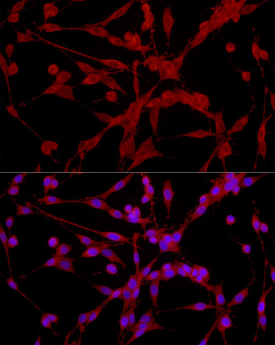 EPHX2 Antibody in Immunocytochemistry (ICC/IF)