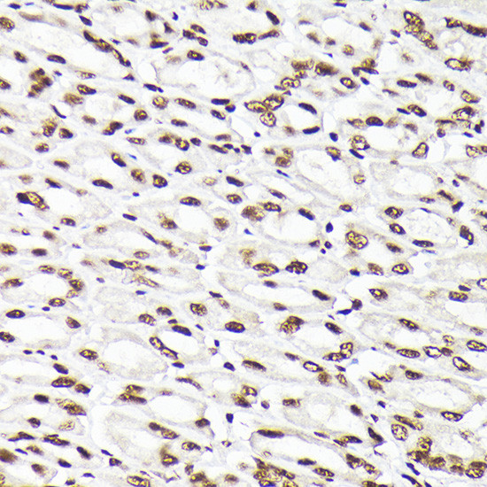 RAD21 Antibody in Immunohistochemistry (Paraffin) (IHC (P))