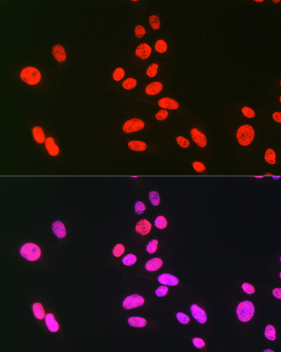 hnRNP C Antibody in Immunocytochemistry (ICC/IF)