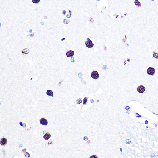 hnRNP C Antibody in Immunohistochemistry (Paraffin) (IHC (P))