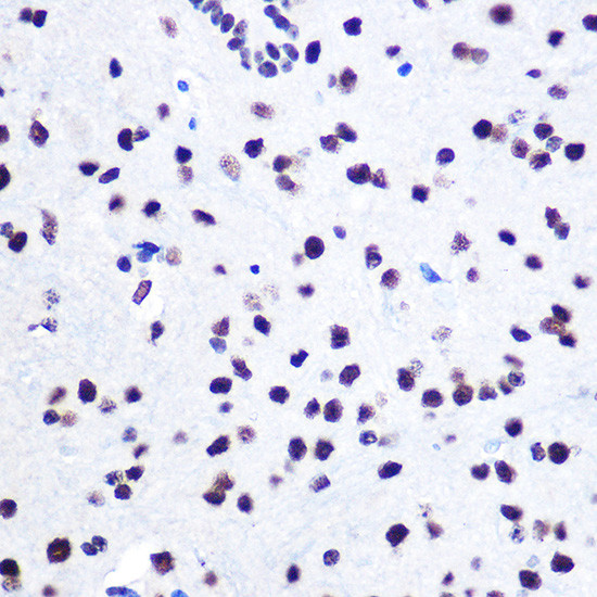 hnRNP C Antibody in Immunohistochemistry (Paraffin) (IHC (P))