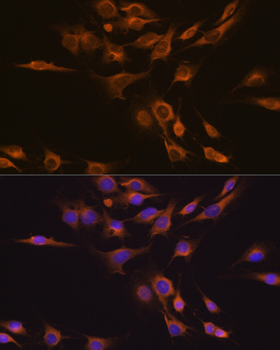 CNTF Antibody in Immunocytochemistry (ICC/IF)