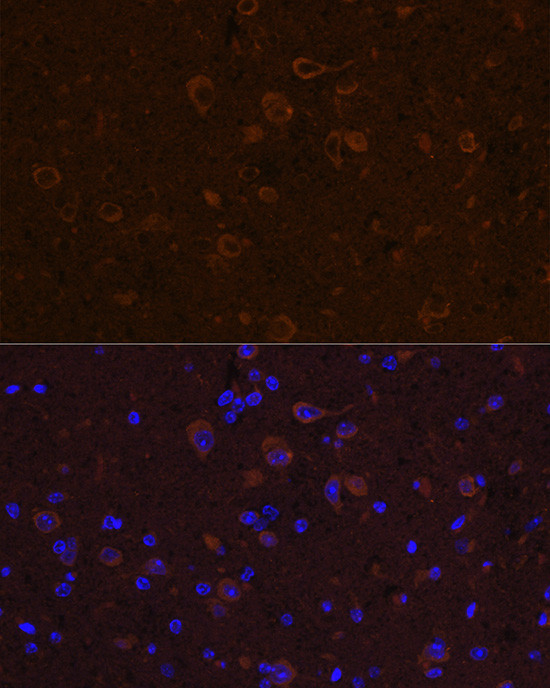 CNTF Antibody in Immunohistochemistry (Paraffin) (IHC (P))