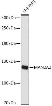 MAN2A2 Antibody in Western Blot (WB)