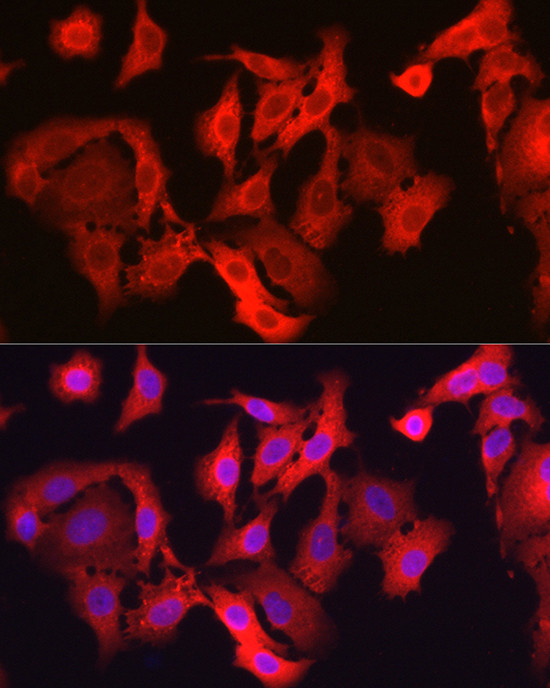 GPX4 Antibody in Immunocytochemistry (ICC/IF)