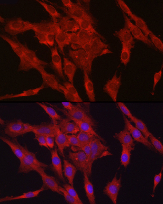 GPX4 Antibody in Immunocytochemistry (ICC/IF)