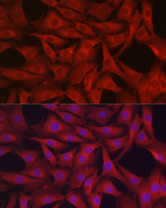 GPX4 Antibody in Immunocytochemistry (ICC/IF)