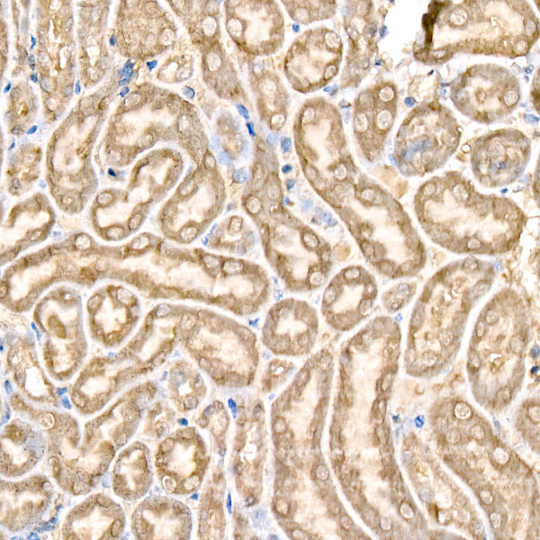 GPX4 Antibody in Immunohistochemistry (Paraffin) (IHC (P))