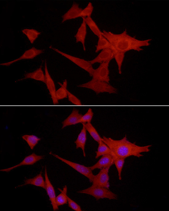 S100A10 Antibody in Immunocytochemistry (ICC/IF)